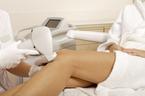 Epilation définitive au laser - Dermatologie Angers